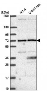 Anti-UTP6 antibody produced in rabbit HPA055806-100UL