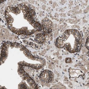Anti-UTRN antibody produced in rabbit 