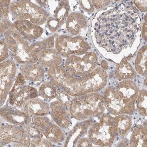 Anti-VAC14 antibody produced in rabbit 