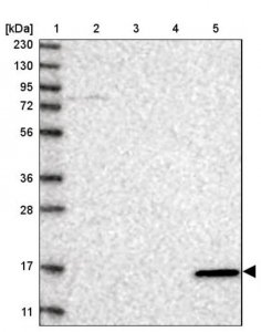 Anti-VAMP5 antibody produced in rabbit 