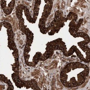 Anti-VBP1 antibody produced in rabbit HPA023230-100UL