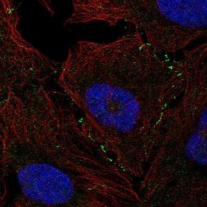 Anti-VCAM1 antibody produced in rabbit 