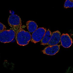 Anti-VCPKMT antibody produced in rabbit 