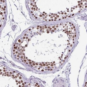 Anti-VCX antibody produced in rabbit 