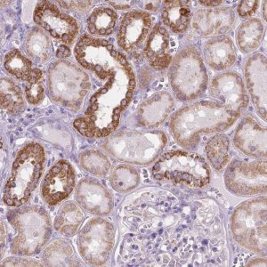 Anti-VDAC1 antibody produced in rabbit 
