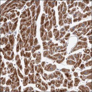 Anti-VDAC3 antibody produced in rabbit HPA026864-100UL