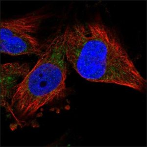Anti-VDAC3 antibody produced in rabbit HPA026864-100UL