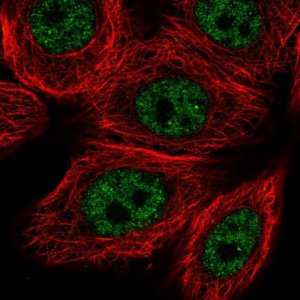 Anti-VDR antibody produced in rabbit 