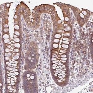 Anti-VENTX antibody produced in rabbit 
