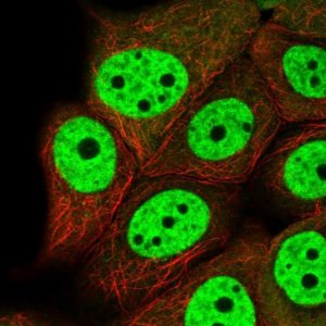 Anti-VHL antibody produced in rabbit 