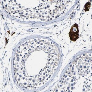 Anti-VMA21 antibody produced in rabbit 