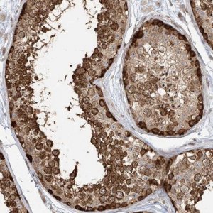 Anti-VMP1 antibody produced in rabbit 