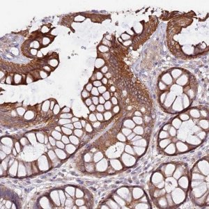 Anti-VPS11 antibody produced in rabbit 