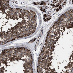 Anti-VPS13A antibody produced in rabbit 