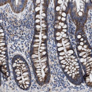 Anti-VPS13A antibody produced in rabbit 