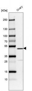 Anti-VPS13B antibody produced in rabbit 