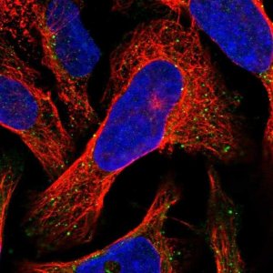 Anti-VPS36 antibody produced in rabbit 