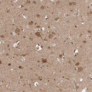 Anti-VPS50 antibody produced in rabbit 