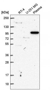 Anti-VPS54 antibody produced in rabbit HPA070582-100UL