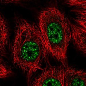 Anti-VPS72 antibody produced in rabbit 