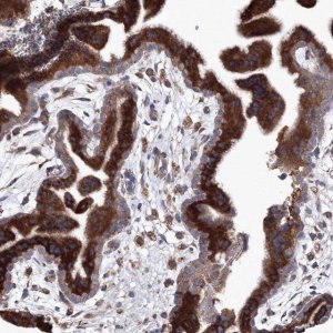 Anti-VPS8 antibody produced in rabbit 