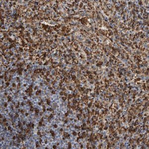 Anti-VPS9D1 antibody produced in rabbit 