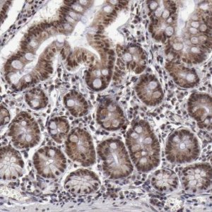 Anti-VRTN antibody produced in rabbit 