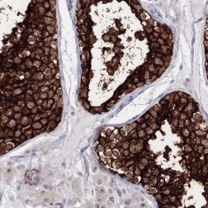 Anti-VSIG1 antibody produced in rabbit 