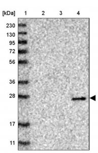 Anti-VSTM2A antibody produced in rabbit HPA021404-100UL