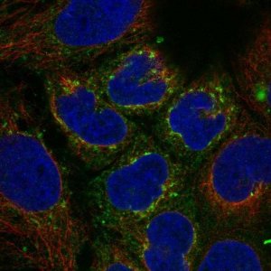 Anti-VTN antibody produced in rabbit 