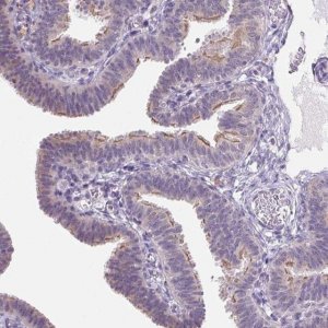 Anti-VWA3B antibody produced in rabbit 
