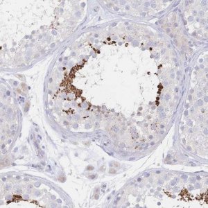 Anti-VWC2L antibody produced in rabbit 