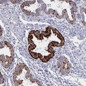 Anti-VWDE antibody produced in rabbit 