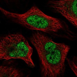 Anti-WAC antibody produced in rabbit 