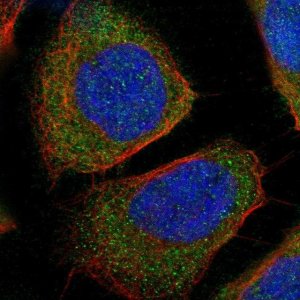 Anti-WARS antibody produced in rabbit 