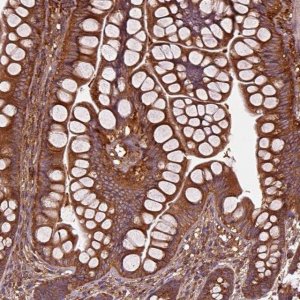 Anti-WASHC2A antibody produced in rabbit 