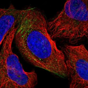 Anti-WASHC3 antibody produced in rabbit 