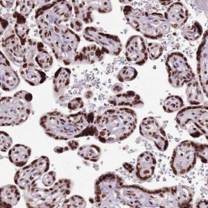 Anti-WASHC4 antibody produced in rabbit 