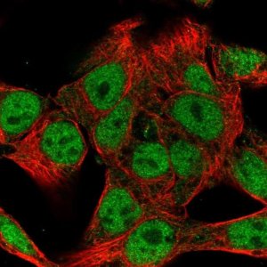 Anti-WASHC4 antibody produced in rabbit 