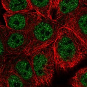 Anti-WASHC5 antibody produced in rabbit 