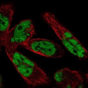 Anti-WBP11 antibody produced in rabbit HPA039710-100UL
