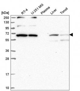 Anti-WBP11 antibody produced in rabbit HPA039710-100UL