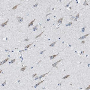Anti-WBSCR17 antibody produced in rabbit 