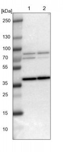 Anti-WBSCR17 antibody produced in rabbit 