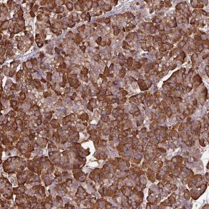 Anti-WBSCR22 antibody produced in rabbit 