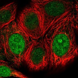 Anti-WBSCR22 antibody produced in rabbit 