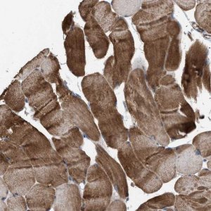 Anti-WBSCR27 antibody produced in rabbit 