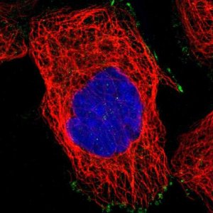 Anti-WBSCR27 antibody produced in rabbit 