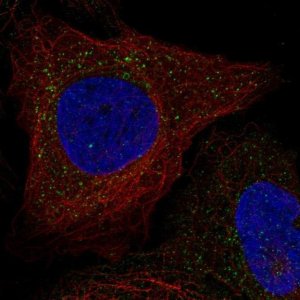 Anti-WBSCR28 antibody produced in rabbit 