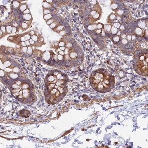 Anti-WDFY4 antibody produced in rabbit 